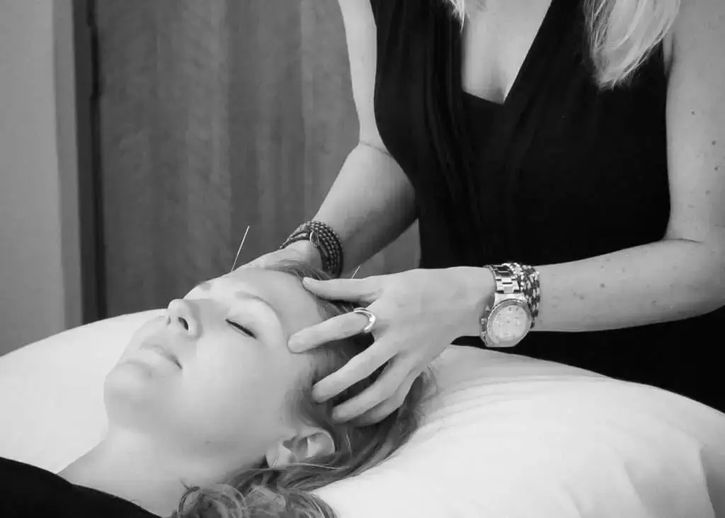 Acupuncture: Mind/Body Therapy