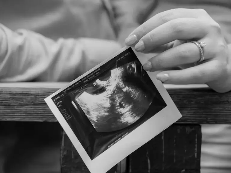 Endometriosis and Fertility