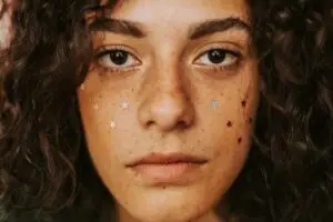 How to Heal Hormonal Acne Naturally